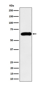 SQSTM1/p62 Rabbit Monoclonal Antibody