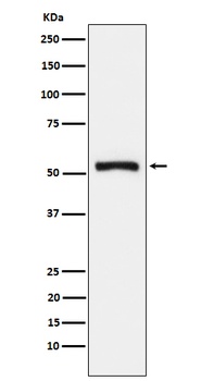 Tryptophanyl tRNA synthetase Rabbit Monoclonal Antibody