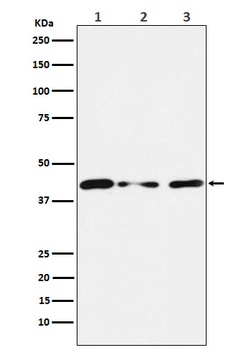 Tin2 Rabbit Monoclonal Antibody