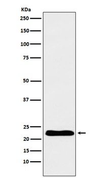 TNNI1 Rabbit Monoclonal Antibody