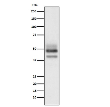 SKP2 Rabbit Monoclonal Antibody