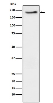 Phospho-ErbB3 Rabbit Monoclonal Antibody