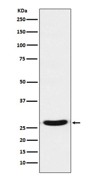 TCF21 Rabbit Monoclonal Antibody