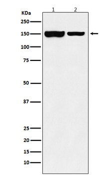 KDM4B/JMJD2B Rabbit Monoclonal Antibody