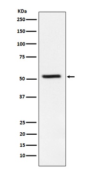 TrpRS Rabbit Monoclonal Antibody