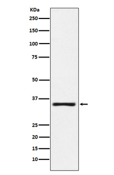KLK2 Rabbit Monoclonal Antibody