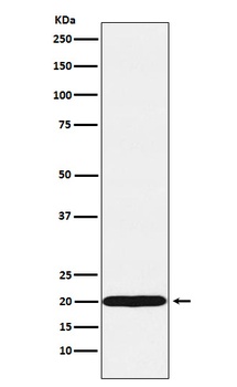 UBE2C Rabbit Monoclonal Antibody