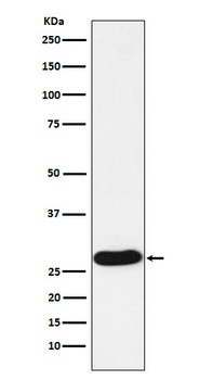 PR3 Rabbit Monoclonal Antibody