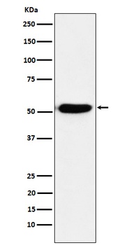 IRF4 Rabbit Monoclonal Antibody