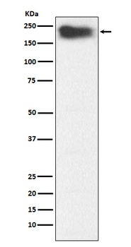MYH7B Rabbit Monoclonal Antibody