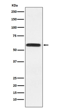 Lgi1 Rabbit Monoclonal Antibody