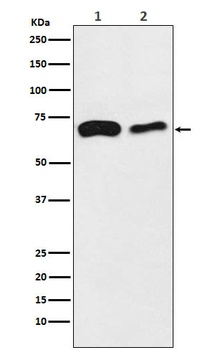 SLC27A4/FATP4 Rabbit Monoclonal Antibody