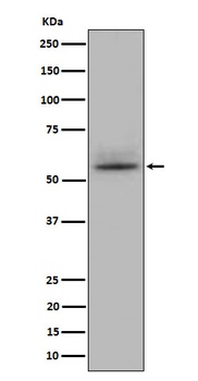 CD147 Rabbit Monoclonal Antibody