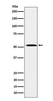 FADS1 Rabbit Monoclonal Antibody