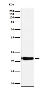 DNPH1 Rabbit Monoclonal Antibody