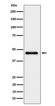 ELP4 Rabbit Monoclonal Antibody