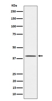 TTF1 Rabbit Monoclonal Antibody