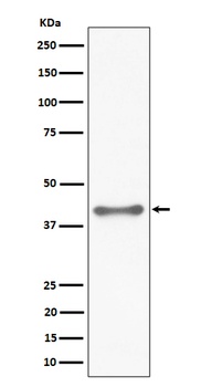 TTF1 Rabbit Monoclonal Antibody