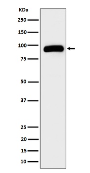 TRPV5 Rabbit Monoclonal Antibody
