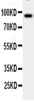 GCSF Receptor/CSF3R Rabbit Polyclonal Antibody