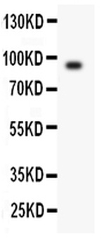 Periostin/POSTN Rabbit Polyclonal Antibody