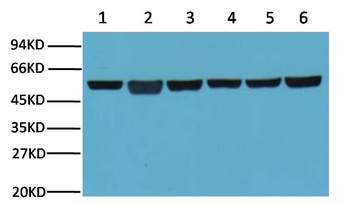β-Tubulin Mouse mAb Antibody