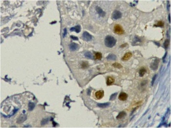 PCNA Mouse mAb Antibody