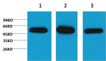 β I tubulin Mouse mAb Antibody