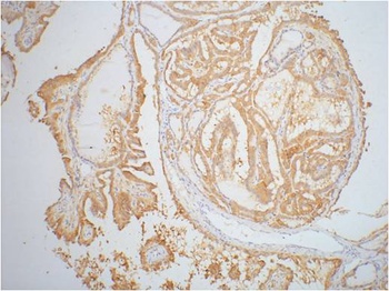 Galectin-3 Mouse mAb Antibody