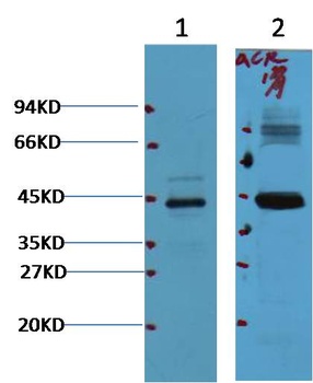 AMACR/P504S Mouse mAb Antibody