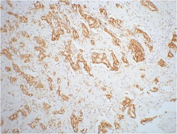 AMACR/P504S Mouse mAb Antibody