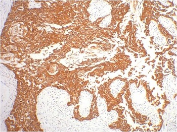 CK16 Mouse mAb Antibody