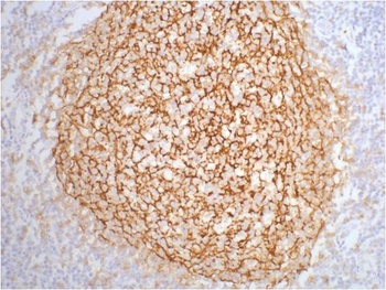 CD21 Mouse mAb Antibody