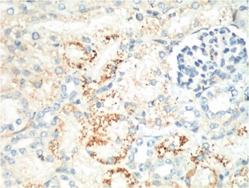 Ki 67 Mouse mAb Antibody