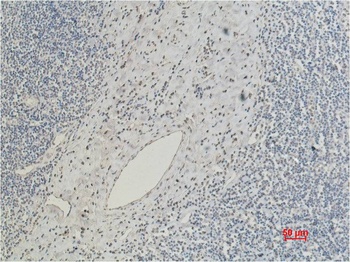 CD5 Mouse mAb Antibody