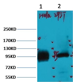 ABCB5 Mouse mAb Antibody