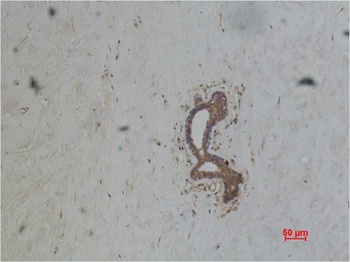 ABCB5 Mouse mAb Antibody
