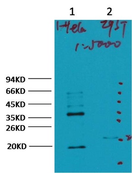 CA IX/Carbonic Anhydrase IX Mouse mAb Antibody