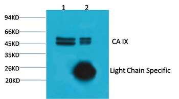 CA IX/Carbonic Anhydrase IX Mouse mAb Antibody