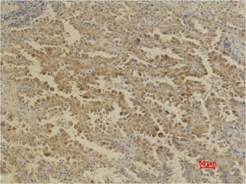 CA IX/Carbonic Anhydrase IX Mouse mAb Antibody