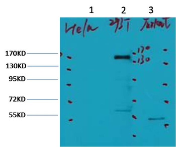 ErbB-2/HER-2 Mouse mAb Antibody