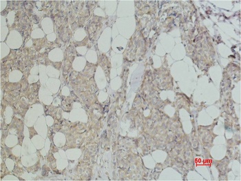 ErbB-2/HER-2 Mouse mAb Antibody
