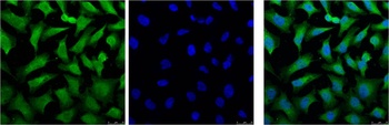 Cytokeratin 18 Mouse mAb Antibody