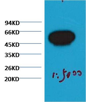 β-Tubulin Mouse mAb Antibody