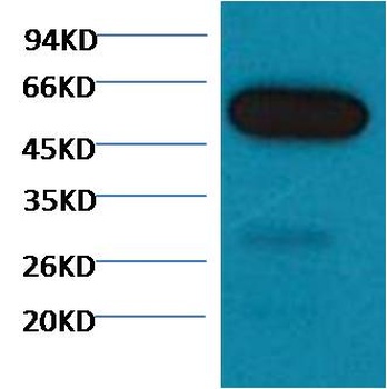 β I tubulin Mouse mAb Antibody