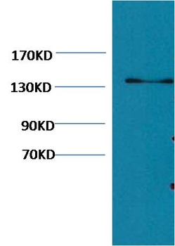 Collagen III Mouse mAb Antibody