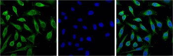 Progesterone Receptor Mouse mAb Antibody