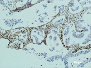 Vimentin Mouse mAb Antibody