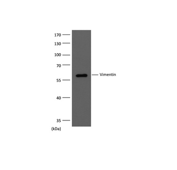 Vimentin Mouse mAb Antibody