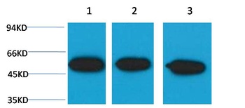 β III tubulin Mouse mAb Antibody